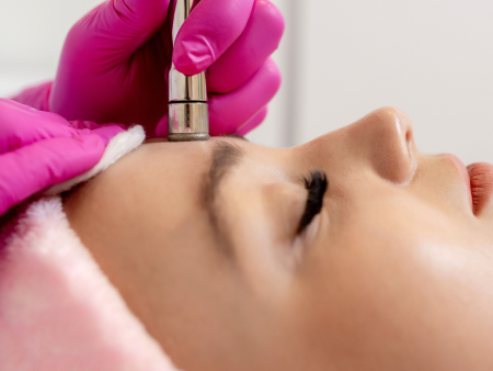 Microdermabrasion on Sale